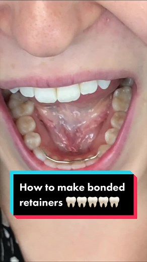 The Braces Guy on TikTok