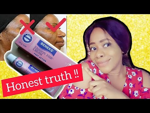 Best Whitening and Bleaching cream? Watch this before Using Benek's fashion fair tube Cream！😢 review