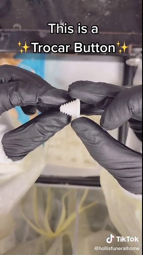 Understanding the Trocar Button in the Embalming Process
