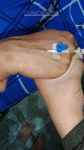 How to Insert IV Line Easil #ytshorts #injection #trending #ytshort