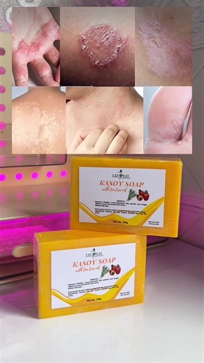 Get 1 Free: Buy Kasoy Soap Today