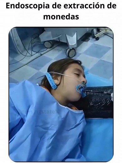 Endoscopia en Niños: Procedimiento y Beneficios