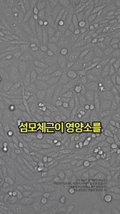 이제 안경이 필요없대요! | 건강지식백과