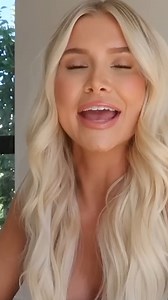 2M views · 12K reactions | Guys, I KNOW I look different #CharlesandAlyssa #Transformation #Surgery #AlyssaHyde | Charles & Alyssa Forever | Facebook