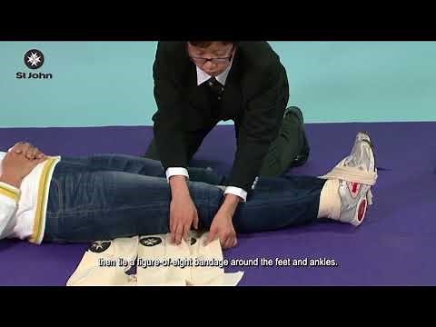 Bandaging Method For Thigh Bone (Femur) Fracture