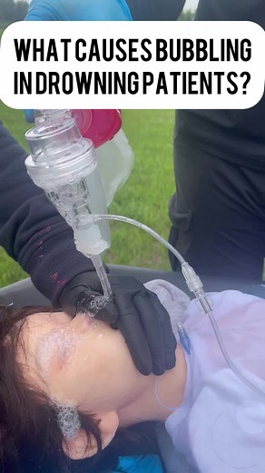 What causes bubbles in drowning patients? 🫧 🤔 Staged scenario* #paramedicstudent #emtstudent #emtschool #emt #emtlife #paramedic #paramedicschool #paramedicos #paramediclife #paramedicscience #paramedical