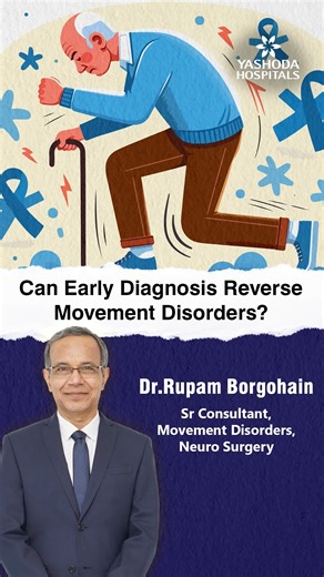 Prof. Dr. Rupam Borgohain, Senior Consultant Neurologist and Programme Director (PDMDRC), Yashoda Hospitals, Hitec City, explains that while not all movement disorders are fully reversible, early diagnosis can significantly slow progression, reduce symptoms, and improve quality of life. Conditions like Parkinson’s disease, dystonia, tremors, and certain genetic or metabolic disorders respond better when identified early. Timely neurological evaluation, advanced imaging, medication optimization,