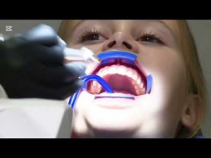 Girls with braces and cheek retractors at dentists