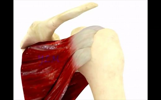 Hill–Sachs损伤骨折