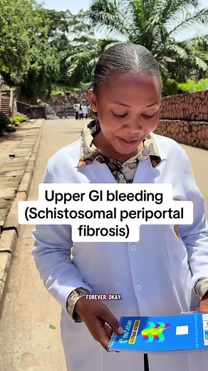 Brilliant diagnosis, I like it😂🔥🔥. Follow for Anatomy & neuroanatomy lessons, Clinical tips (YouTube: NeuroSketch with Dr Kenny) #Neurosketchtz, #Neurosketch #fyp #EduTok #viral Upper GI bleeding (UGIB) secondary to schistosomal periportal fibrosis. Internal medicine, medicine life Q & A with Cuhas students 🔥🔥@Coco~melow🫢💕 @Kenny 🇮🇹 🇹🇿