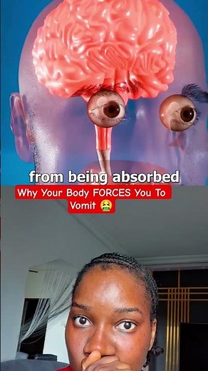 Why Vomiting Can Actually Save Your Life ⚠️ #diseplee