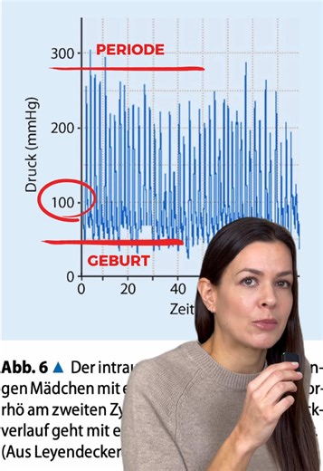 Und jetzt soll nochmal jemand sagen „Stell dich nicht so an“ oder „Das ist ganz normal“🩸 ❌Für viele Frauen bedeutet die Periode Schmerzen, die den Alltag massiv einschränken und nur mit Medikamenten zu ertragen sind - und das ist alles andere als „normal“. ➡️In diesem Beispiel wurde bei einem jungen Mädchen mit Adenomyose und starken Periodenschmerzen der Druck in der Gebärmutter gemessen. ➡️Das Ergebnis zeigt: die Ausschläge sind höher als bei den meisten Frauen* in der Endphase einer Geburt. 