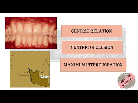 Centric Relation | Centric Occlusion | Maximum Intercuspation