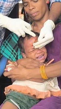 Furuncle incision, drainage and treatment | Boil incision | Part-1 #injury