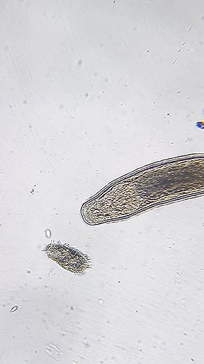 Gieysztoria Flatworms Eating Ciliates - Digestion Process Revealed!