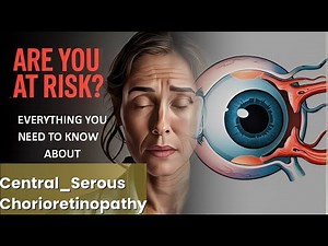 Central Serous Chorioretinopathy Explained Causes, Symptoms and Treatment, All Insights