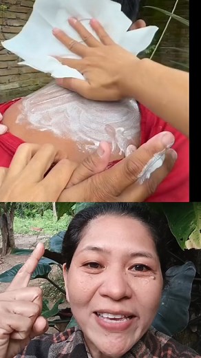 Baking soda, toothpaste, at lemonsito #skincare | Flor Gaco Avergonzado