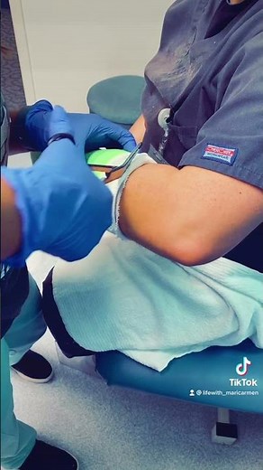 ULNAR GUTTER CAST REMOVAL 😀