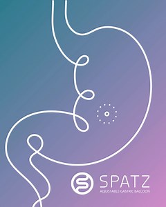 ¿Qué hace único a Spatz3? Su ajustabilidad. Puede disminuir su tamaño si presentas molestias ⬇️ o aumentarlo para mejorar los resultados. ⬆️ ¿Quieres conocer más? Envíanos un mensaje directo. | Spatz Balón Gástrico Ajustable - México