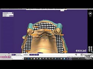 CERIK3D - Video 2 - Exocad, Partial CAD. PPR Digital Design