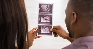 Dating scan: your 12-week pregnancy scan - Netmums