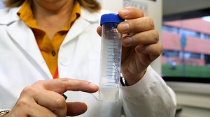 PCR con muestra de saliva: una alternativa para detectar la presencia de SARS-CoV-2