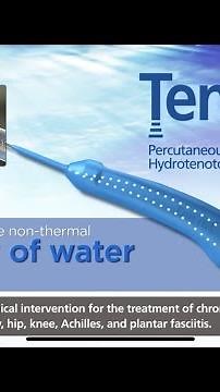 TENJET (TENOTOMY) TO TREAT TENDINOPATHY OF THE SHOULDER