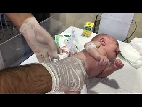 Suppository Use for Abdominal Distension Tips and. Managing Abdominal Discomfort with Suppositories