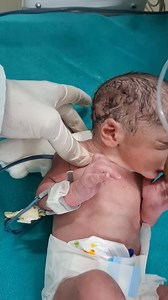 13K views · 234 reactions | For a premature baby after birth, a CPAP spot (Continuous Positive Airway Pressure) is a common, non-invasive way to support their immature lungs by delivering pressurized air via nasal prongs, helping keep airways open, #prematurebaby #petadoption #fatherhood #truelove #wordplay #deception #infidelity #humor #TrustIssues #fear #confrontation #parenting #momlife | Pooja Parmjeet Kaliramna | Facebook