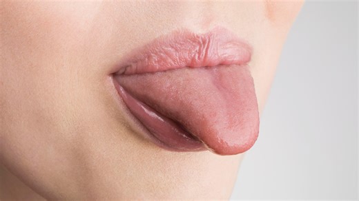 What is hairy tongue? The lowdown on the common (but not very pretty) condition