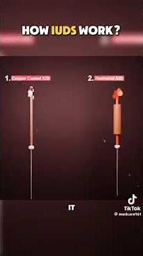 Ever wondered how an IUD works?