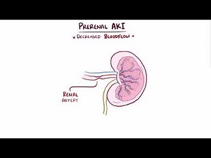 Prerenal acute kidney injury acute renal failure causes, symptoms & pathology