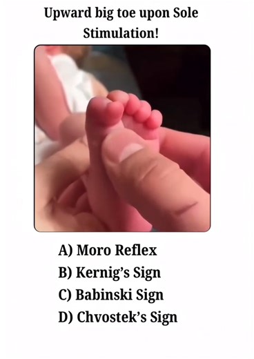 17K views · 140 reactions | Spot the reflex! 良喙 [ Check-Out the comment section for Correct Answer ]  | medicalmania007 | Facebook