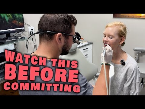 I Got Veneers! Here’s What the Process Is REALLY Like #notsponsored