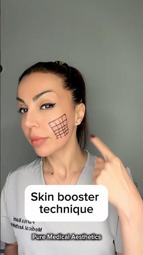 Skin booster technique