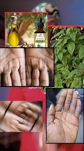 CEE DEM UPDATE on TikTok