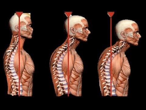 How to TRULY correct forward head posture