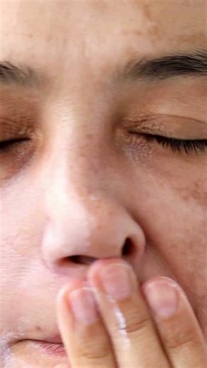 Hyperpigmentation & Dark Spots: What Really Helps