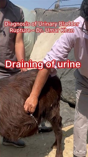 Diagnosis of Urinary Bladder Rupture – Dr. Umar Khan