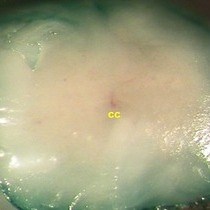 In Vivo SiRNA Transfection and Gene Knockdown in Spinal Cord via Rapid Noninvasive Lumbar Intrathecal Injections in Mice