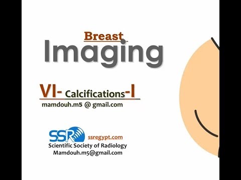12- Breast Imaging Part (VI) Calcifications - Prof Mamdouh Mahfouz
