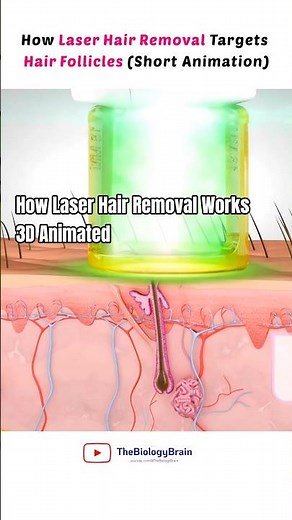 How Laser Hair Removal Works Explained. #laserhairremoval