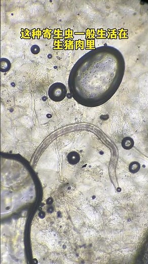 Does pork really have parasites? The world under the microscope Microscopic world Popular scienc