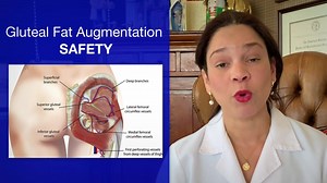 In this video, Dr. @Alexandra Condé Green discusses the article “Influence of Age, Sex, and Body Mass Index on the Thickness of the Gluteal Subcutaneous Fat: Implications for Safe Buttock Augmentation Procedures” by Frank, Casabona, Gotkin, Kaye, Lorenc, Schenck, Lachman, Green, Duran-Vega, and Cotofana, which appears in the July 2019 issue of Plastic and Reconstructive Surgery, Volume 144 Issue 1. Read it: http://bit.ly/SafeButtockAug | Plastic and Reconstructive Surgery