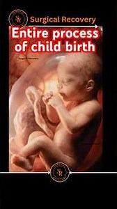 Process of child birth #pregnancy #pregnant #childbirth #babyboy #babygirl #infertility #pcod #mbbs