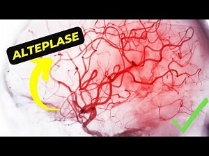 Alteplase: Understanding its Mechanism of Action and Potential Side Effects