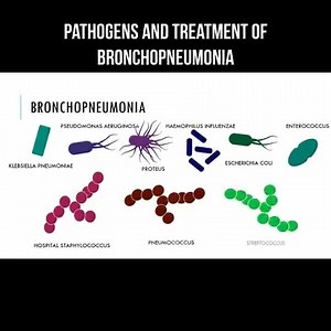 Pathogens and treatment of bronchopneumonia The causative agents of bronchopneumonia can be: Klebsiella pneumonia; Pseudomonas aeruginosa; Proteus; hemophilic bacillus; coli; enterococcus; hospital staphylococcus; Pneumococcus; streptococcus. Depending on the antibiogram, antibiotic therapy is prescribed: Co-trimoxazole; Ampicillin; Penicillin. #pathogens #bronchopneumonia #pneumonia #Bronchopneumoniatreatment | About health and science in simple words | Facebook