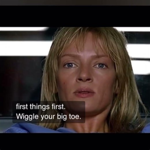 Successful bunionectomy #podiatry #bunionectomy #footsurgery