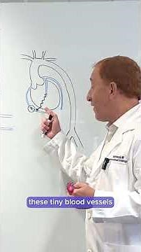 Chronic Total Occlusion (CTO)
