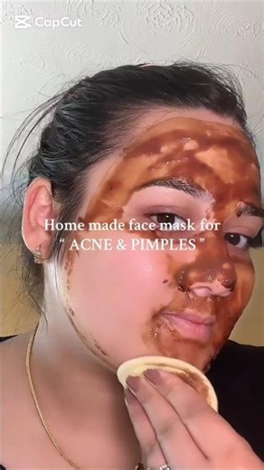 Home made face mask for Acne & Pimples #beautytips #skincare #trending #shorts #ytshorts